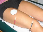 Elettrostimolazione Muscolare